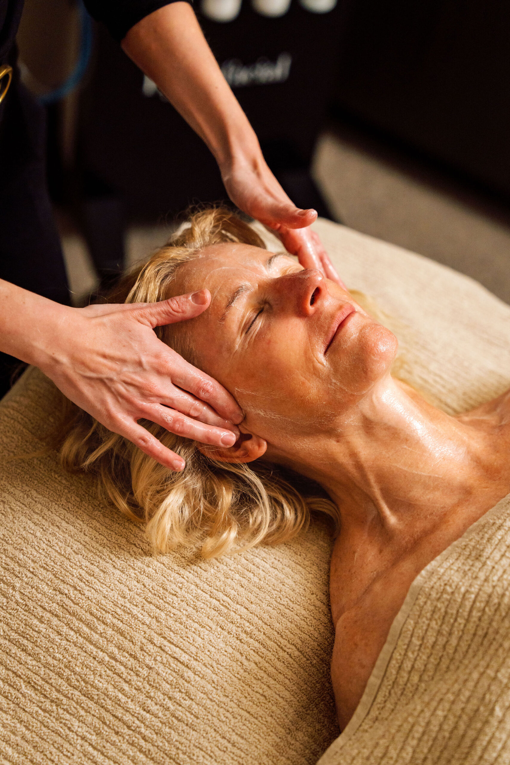 Microneedling treatment being carried out at TCMA