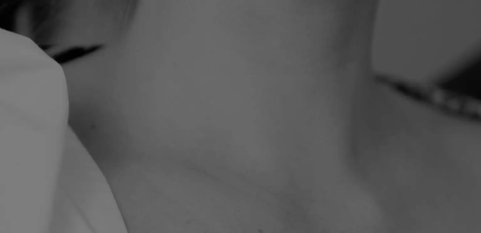 Skin tag, lesion and mole assessment at TCMA in Surry Hills
