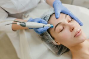 how many microneedling sessions for acne scars