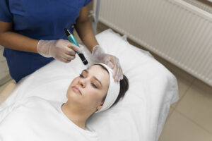 how many microneedling sessions for acne scars